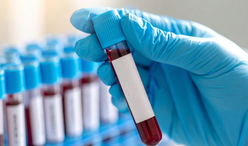 Duro Health Blood Testing Services